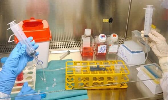 Dal Regina Margherita una nuova speranza contro i tumori ossei pediatrici: allo studio “navette biologiche” per trasportare i farmaci