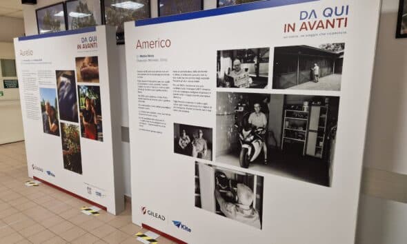 Da qui in avanti, parte da Torino la mostra testimonianza della vita che ricomincia grazie alla terapia con le CAR T